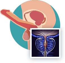 Supporto alla vitalità